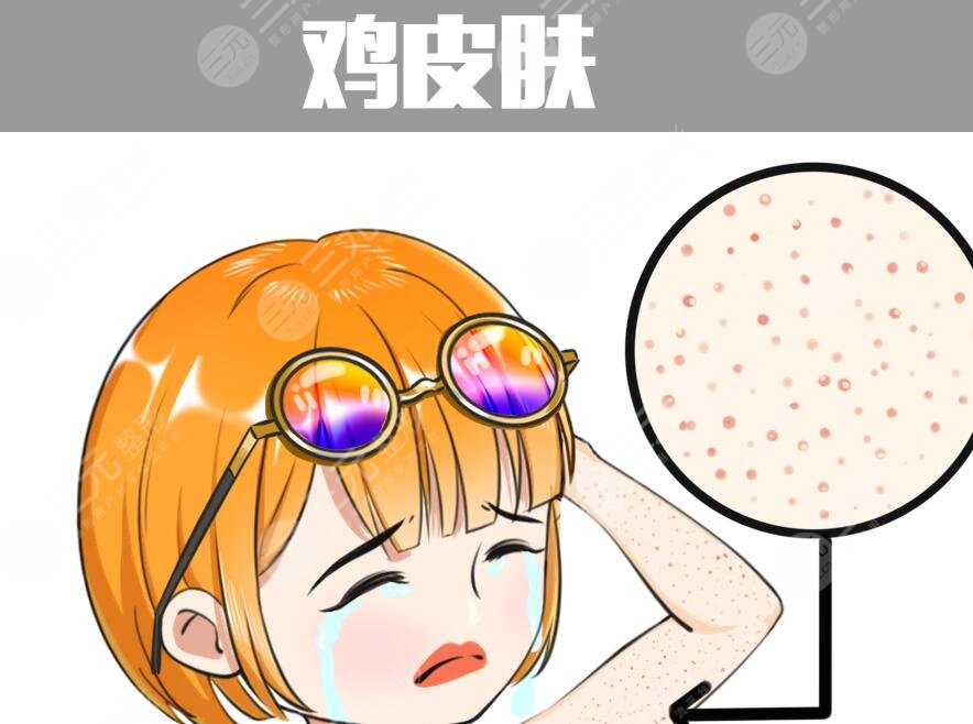 雞皮疙瘩皮膚怎么治見(jiàn)效快？預(yù)防和根治雙重入手，避免反復(fù)發(fā)作！