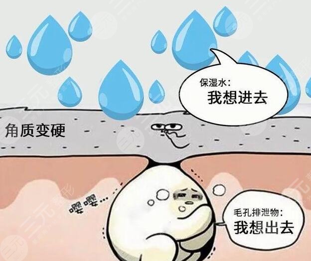 醫(yī)美去角質(zhì)的方法——如何選擇適合自己的醫(yī)美方式