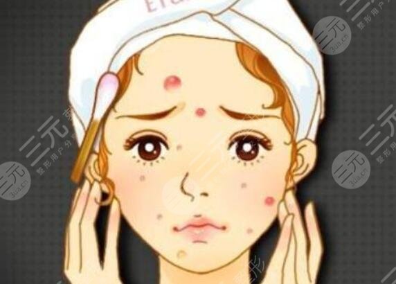 淡化紅色痘印的護(hù)膚品