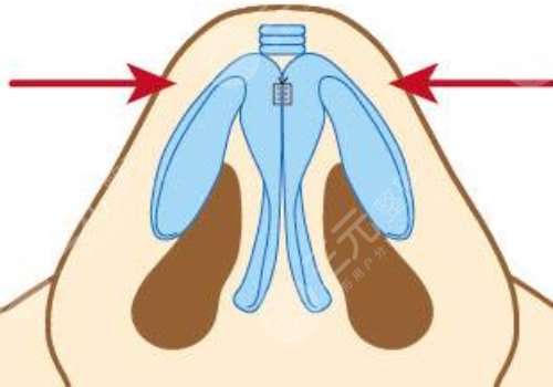 李信鋒醫(yī)生擅長項目