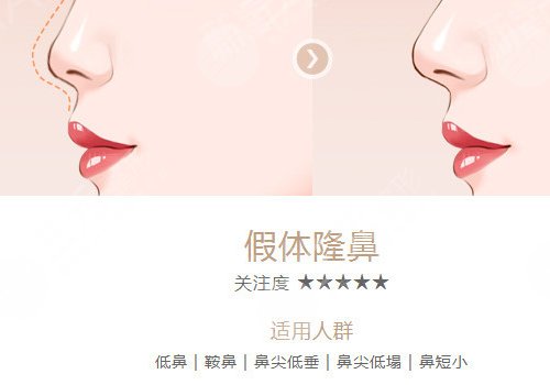 重慶軍科醫(yī)院林勇做鼻子好嗎?