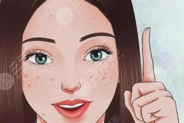 緩解青春痘費用大概多少錢？哪些方法有效且安全可靠？