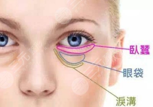 眼袋怎么消除？