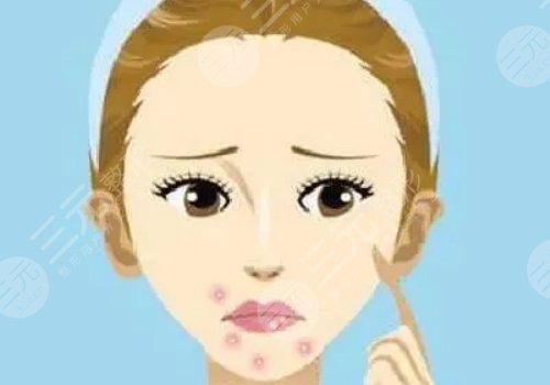 口周一直長(zhǎng)痘痘什么原因？