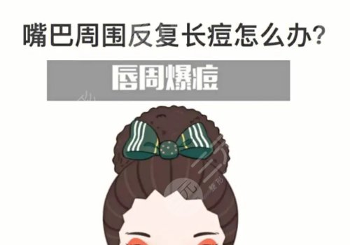 口周一直長(zhǎng)痘痘什么原因？