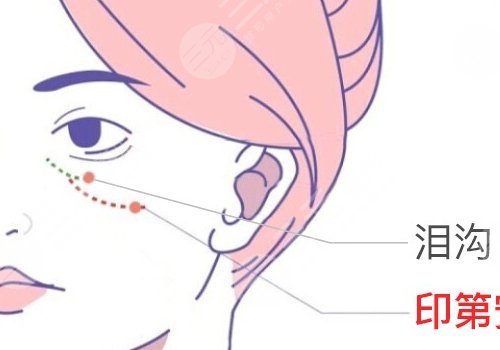 淚溝與眼袋的區(qū)別圖