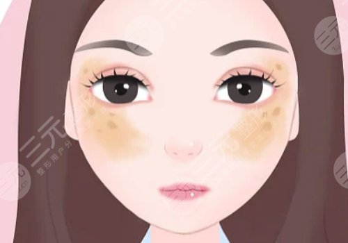 臉上長(zhǎng)了色斑是什么原因造成的?