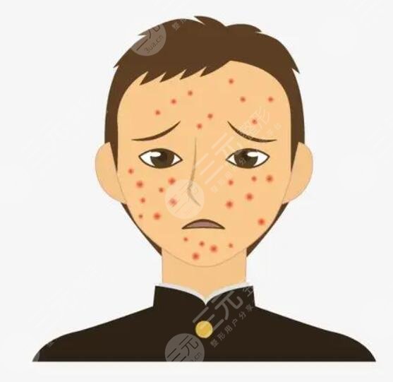 適當?shù)倪\動和休息