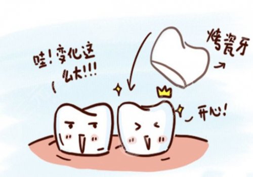 鈷鉻烤瓷牙套怎么樣？