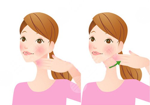 自體脂肪隆下巴多少錢？