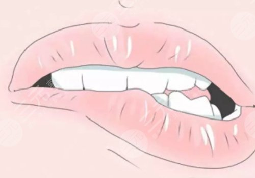 嘴唇厚如何變薄?