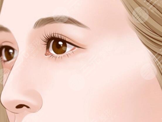 墊鼻梁有什么后遺癥嗎？手術(shù)伴隨的風(fēng)險(xiǎn)和副作用該怎么規(guī)避？