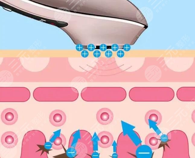 美容儀分類及效果