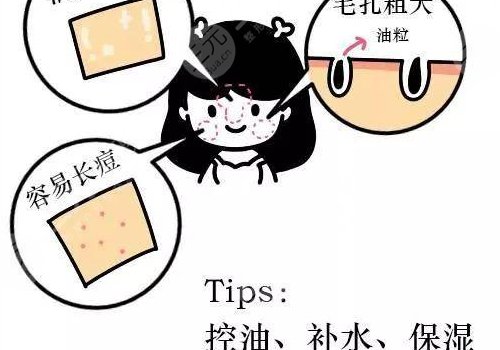 油性皮膚護(hù)理方案揭曉