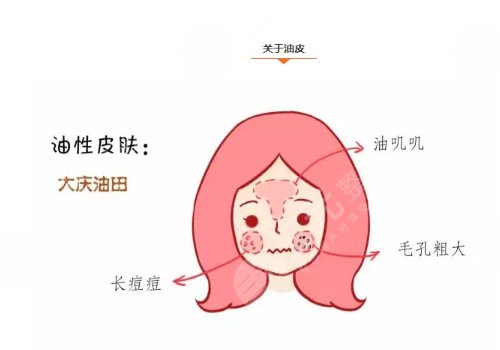 油性皮膚護(hù)理方案揭曉