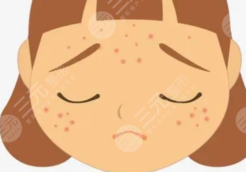 如何去除臉上的青春痘？