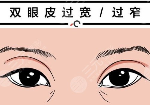 雙眼皮修復(fù)大概多少錢呢？