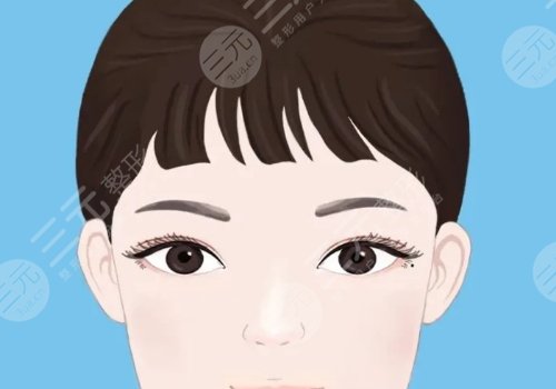 雙眼皮修復(fù)大概多少錢呢？