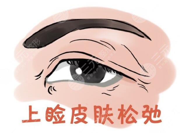 眼瞼皮膚松弛是什么?