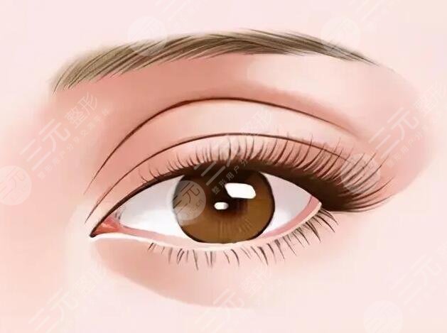 眼瞼皮膚松弛矯正術(shù)適合哪些人群?