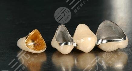 全瓷牙價格影響的因素