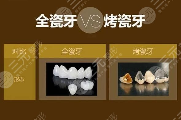 全瓷牙一顆大概多少錢呢？文中4個因素在影響手術(shù)價格！