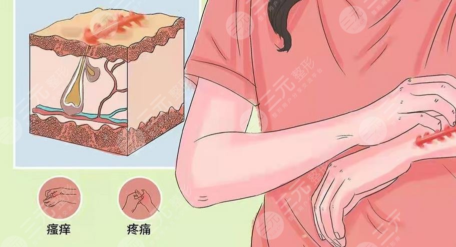 有傷疤怎么去掉？