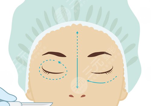 切雙眼皮多久能恢復(fù)自然？