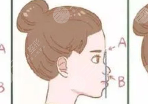 嘴凸是怎么造成的？