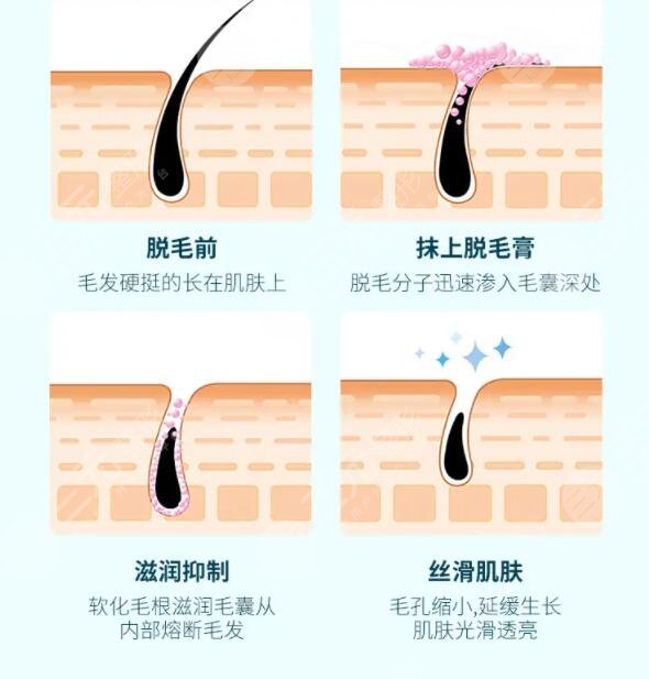 veet脫毛膏注意事項(xiàng)有哪些?