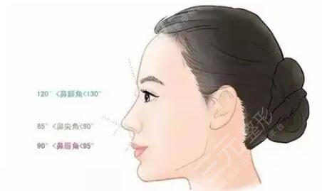 自體軟骨隆鼻好不好看？是從哪里取軟骨？優(yōu)缺點一文匯聚！