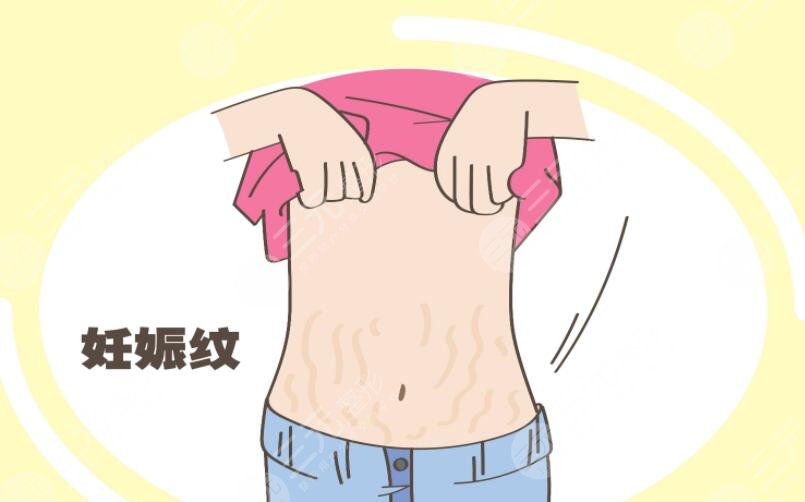 橄欖油去妊娠紋有副作用嗎?