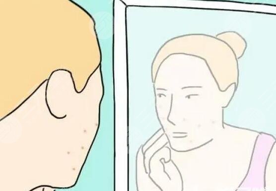 激光緩解青春痘有哪些優(yōu)勢?