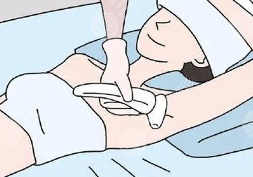 脫毛儀哪個(gè)牌子效果比較好？