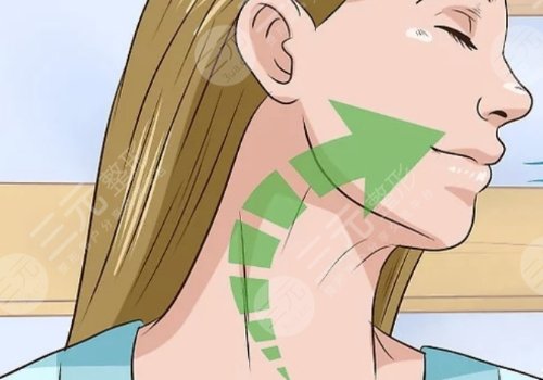 頸紋特別深怎么去除？