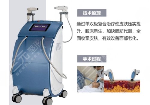 深藍(lán)射頻做一次有效果嗎？