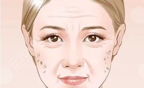 如何消除老年斑有效的方法：食療_醫(yī)美_日常護理多方面入手！