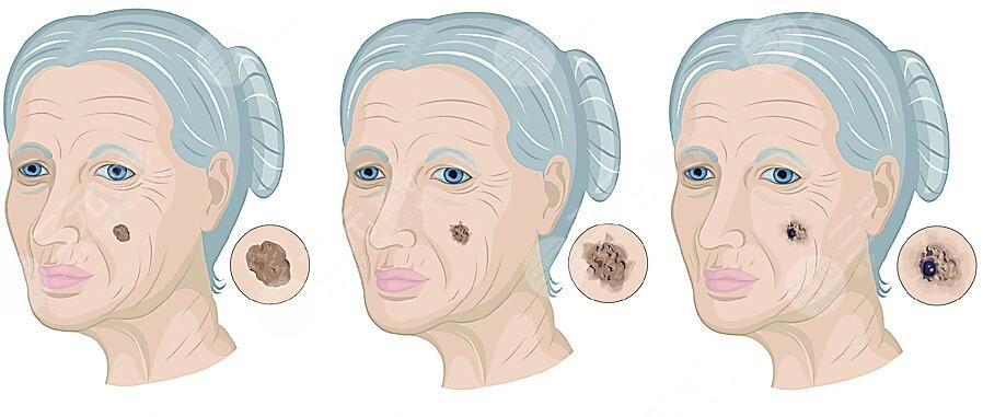 內(nèi)在調(diào)養(yǎng)