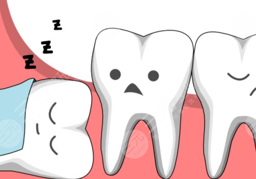 拔智齒幾天才能恢復(fù)正常?