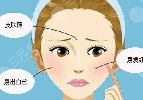 臉上長(zhǎng)紅血絲怎么去掉？