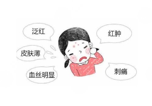 臉上長(zhǎng)紅血絲怎么去掉？