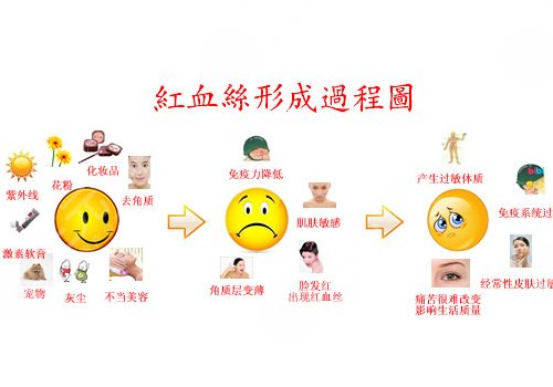 臉上長(zhǎng)紅血絲怎么去掉？