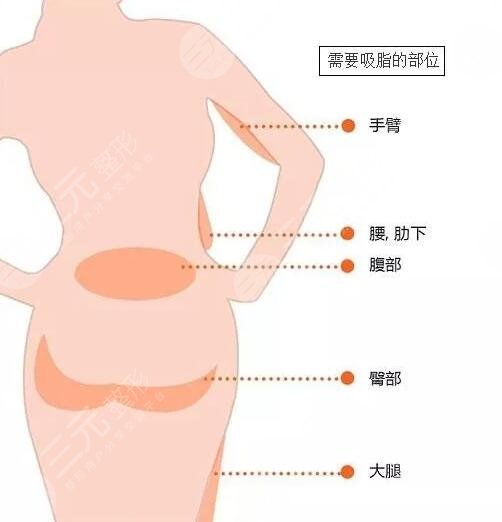 腿部吸脂手術(shù)有什么危害嗎?