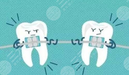 牙齒矯正時間長短影響因素