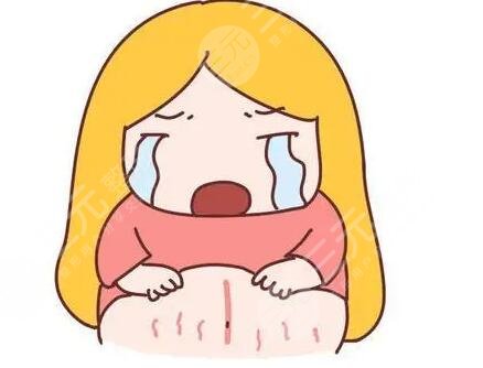 橄欖油預(yù)防妊娠紋有效嗎?