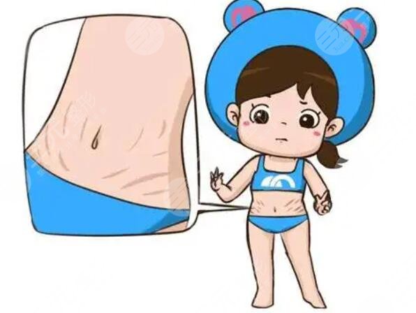 橄欖油預(yù)防妊娠紋有效嗎?