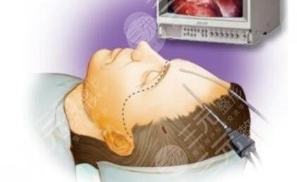 八大處整形醫(yī)院開展項目