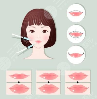 嘴唇薄好還是厚好?