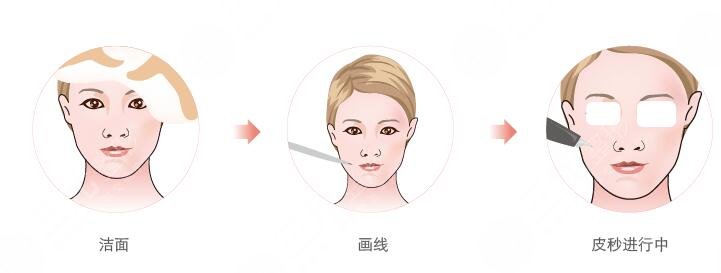 美白注射，水光注射管用嗎?