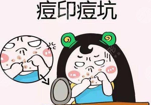 臉上有痘印怎么辦才能去掉呢？